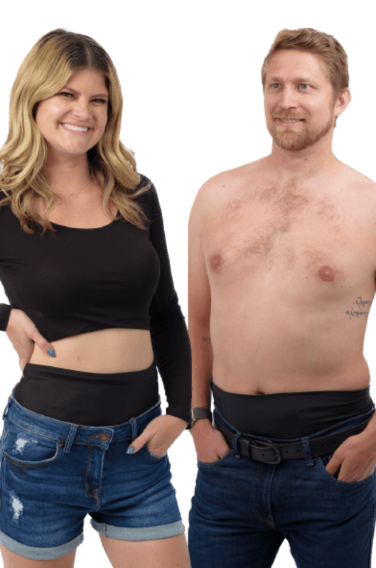 Colostomy Ostomy pouching system Stoma Ileostomy Clothing Accessories,  others, swimwear, abdomen, clothing Accessories png